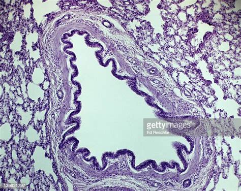 Cross Section Of The Lungs Photos Et Images De Collection Getty Images