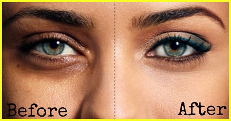 How To Use Almond Oil To Reduce Dark Circles