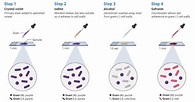 Gram Staining- Principle, Reagents, Procedure, Steps, Results