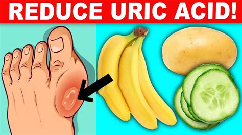 Help With High Uric Acid Know Your Disease With Diet Tip Shades Of Octaves