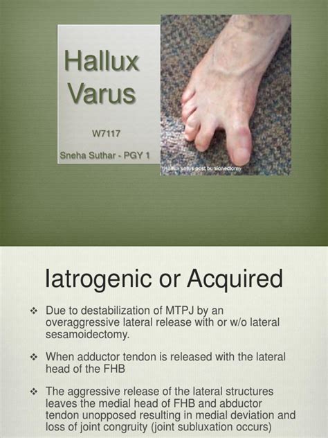 Hallux Varus Pdf Toe Anatomical Terms Of Motion