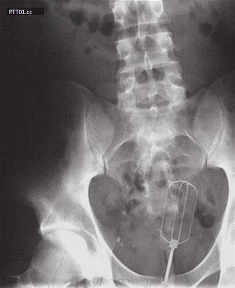 31 Funny X Ray Images That Seem Too Ridiculous To Be Real