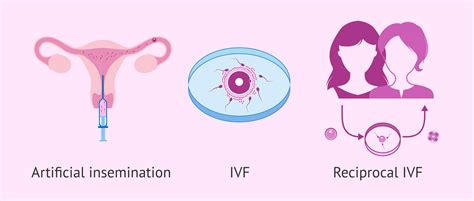 what is reciprocal ivf everything lesbian couples need to know