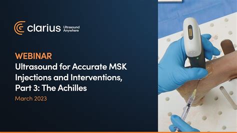 Ultrasound For Accurate Msk Injections And Interventions Part 3 The