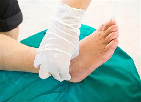 Diabetes And Charcot Foot Syndrome Foot Health Clinic Podiatry