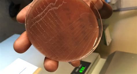 New Research Examines Antibiotic Resistance In Gonorrhea In Kenya