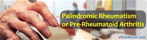 Palindromic Rheumatism Or Palindromic Arthritiscausessymptoms