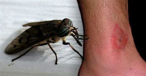 Here Are 8 Common Bug Bites And How You Can Recognize Them