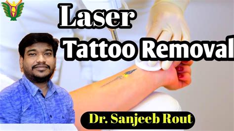Laser Removal Of Tattoo 2nd Session Balaji Skin And Hair Dr