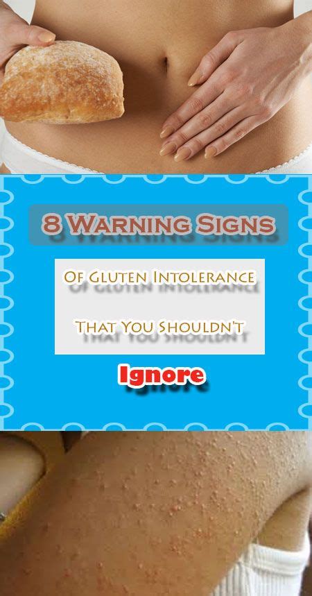 8 Warning Signs Of Gluten Intolerance That You Shouldnt Ignore Signs