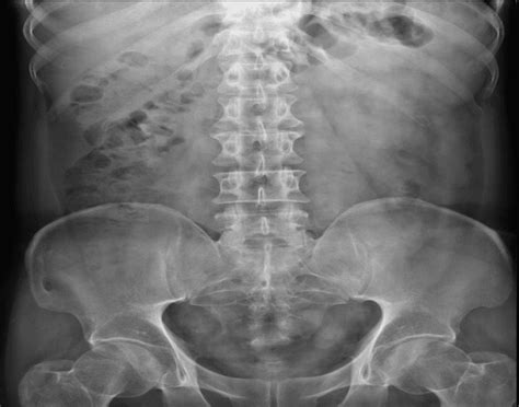 Abdomen X Ray Anatomy Quiz