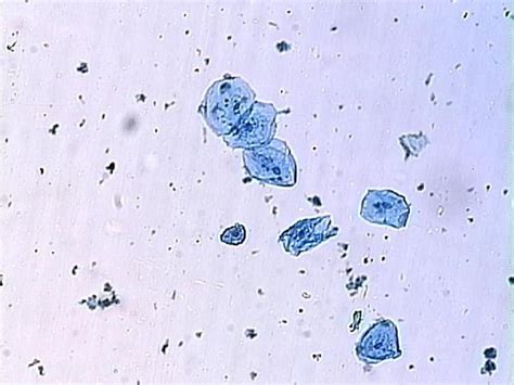 Cheek cells under a microscope. What is the shape of cheek cells and how can you find out ...