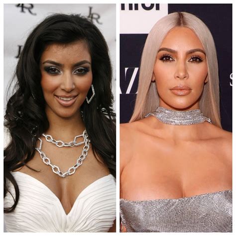 kim kardashian before and after plastic surgery timeline