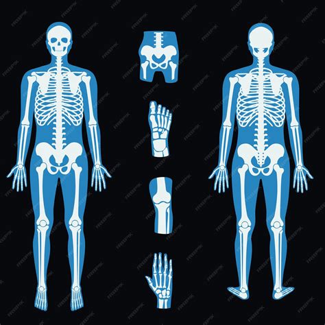 Premium Vector X Ray Clipart Chest Bones Medical Treatment