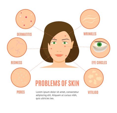 Diagram Showing Different Skin Conditions — Stock Vector