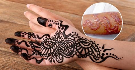 Ash Kumar Explains How To Tell If Someones Using Illegal Black Henna