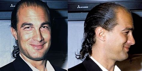 What Happened To Steven Seagals Hair