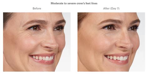 Botox Rejuv Spa And Cosmetic Center