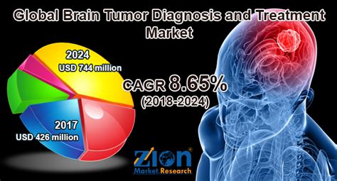 Brain Tumor Diagnosis And Treatment Market By Diagnosis Mri Ct Scan