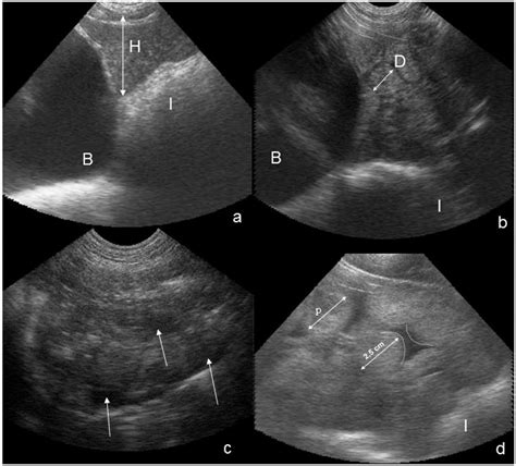 Transabdominal Ultrasound Images Falco Esaote Pie Medical 5 Mhz