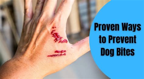 Proven Ways To Prevent Dog Bites