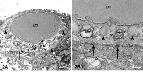 —electron Micrograph Of The Eosinophilic Cytoplasmic Inclusions Ecis