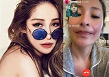 Elva Hsiao Recovers from Dog Bite Laceration on Her Face - DramaPanda