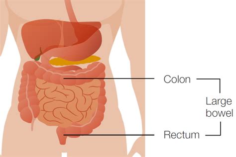 Bowel cancer symptoms can be quite difficult to spot in its early stages, but there are some key warning signs of the condition to watch out for smoking, drinking too much alcohol and obesity could also lead to the disease, the nhs warned. NHS bowel cancer screening: helping you decide (FIT kit ...