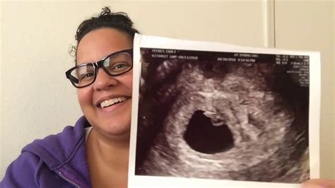 6 7 Week Pregnancy Update 😲 First Ultrasound Pregnancy After