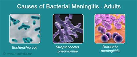 Bacteria That Causes Meningitis