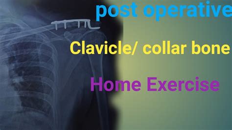 Post Operative Clavicle Bone Exercise Clavicle Surgery Rehab Exercise