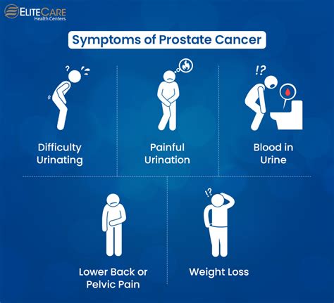 The Importance Of Prostate Cancer Screening Elitecare Hc