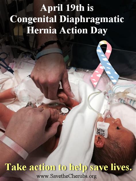 Congenital Diaphragmatic Hernia Congenital Diaphragmatic Hernia Action Day