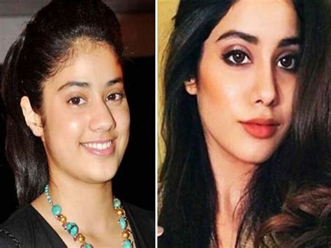 Jhanvi Kapoor Has Gone Under The Knife For A Slimmer Nose And Jawline