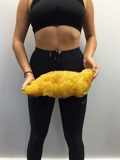What 5lbs Of Fat Looks Like —
