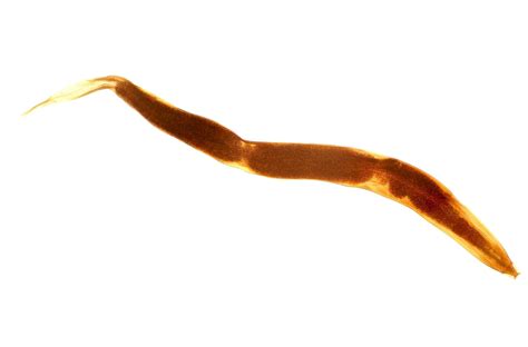 What Are Pinworms Treatment And Symptoms