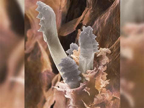 Demodex Mites In Human Skin