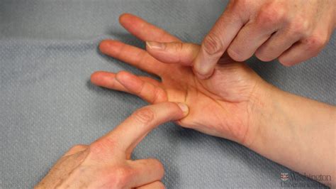 Handfinger Fracture Lockeroom Health