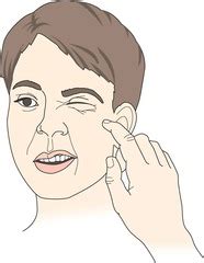 It is obtained by striking with a finger or a hammer a point that is approximately 2 cm in front of the lobe of the ear and about 1 cm below the zygomatic process. Chapter 10 notes by Paula Flashcards | Quizlet