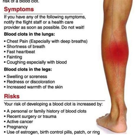 Blood Clot In Leg Symptoms