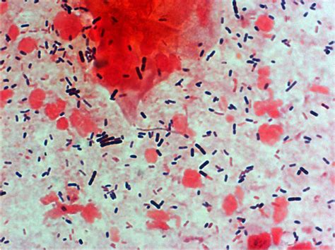 Filebacteria Gram Stained Vaginal Smear 05 Embryology