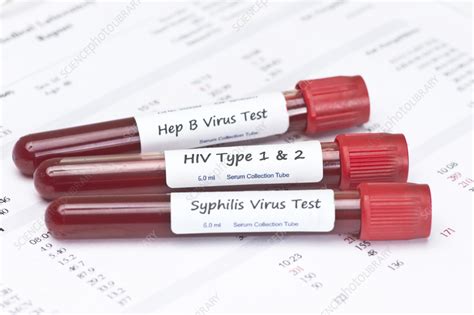 Std Tests Stock Image F0358874 Science Photo Library