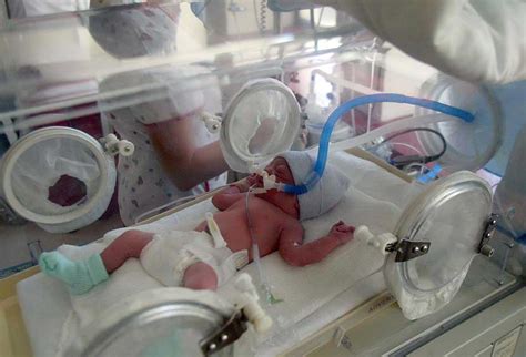 Estaban A Punto De Cremar A Un Bebé Prematuro Declarado Muerto Pero
