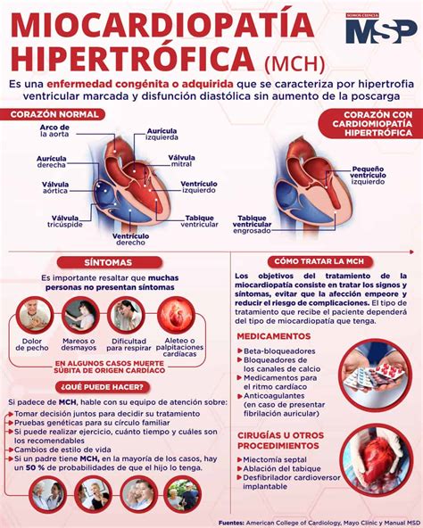 Cardiomiopatía hipertrófica Infografía