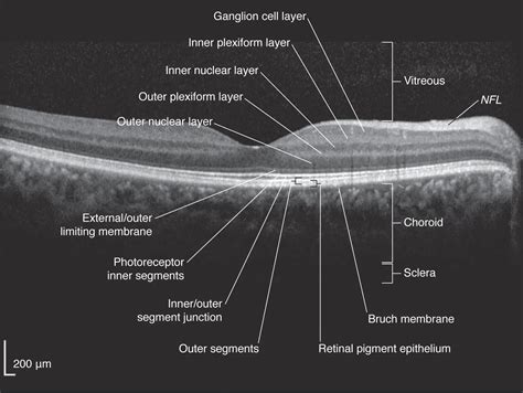 Optical Coherence Tomography American Academy Of Ophthalmology