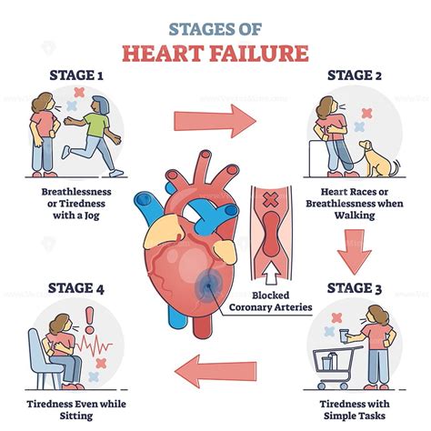How To Improve Time To Diagnosis In Acute Heart Failure