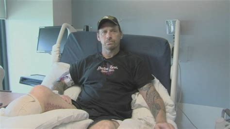 Florida Man Lucky To Be Alive After Contracting Flesh Eating Bacteria Abc7 Los Angeles