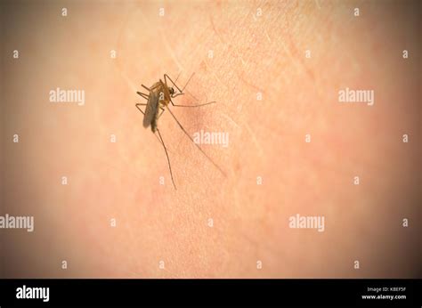 Mosquito Bites Hi Res Stock Photography And Images Alamy