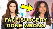 Gauri Khan Plastic Surgery Gone Wrong | SHOCKING Face Transformation ...
