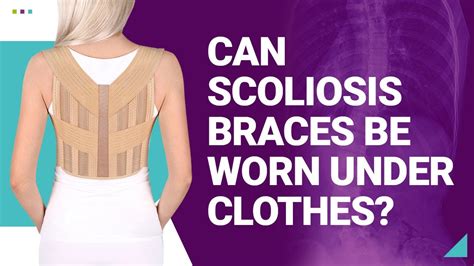 Can Scoliosis Braces Be Worn Under Clothes Youtube